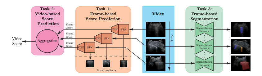 Deep learning for classification and localization of COVID-19 markers in point-of-care lung ultrasound